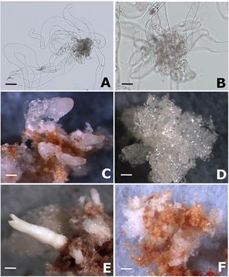 Proteomic Analysis of S-Nitrosation Sites During Somatic Embryogenesis in Brazilian Pine, Araucaria angustifolia (Bertol.) Kuntze